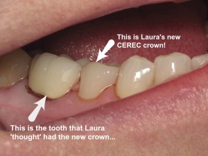 CEREC