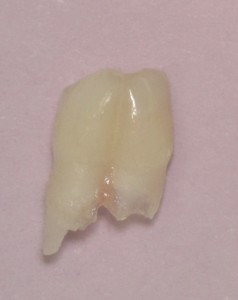 Tooth