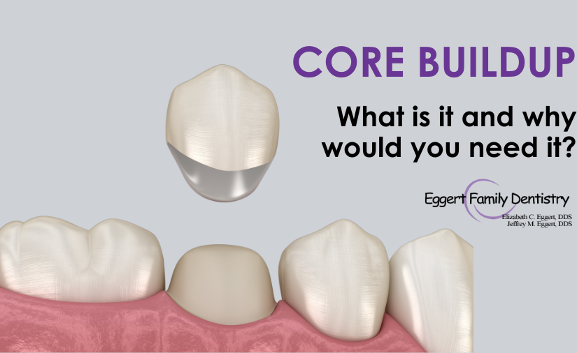 What Is a Core Buildup, and Why Would You Need One?