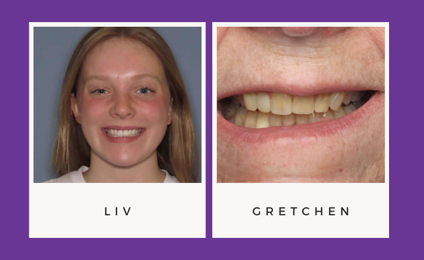 What Can Composites Do for You? – Liv’s and Gretchen’s Stories