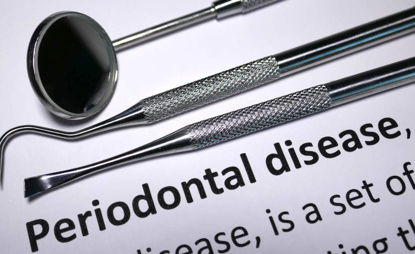 Worried About Periodontal Disease? Don’t Skip Your Regular Dental Check-ups!
