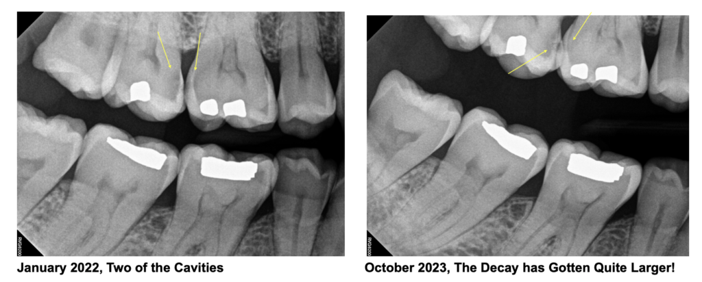 Halloween Wax Lips and Teeth - Devoted Family Dental