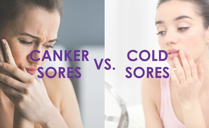 Canker Sores vs. Cold Sores [and How to Treat Each!]