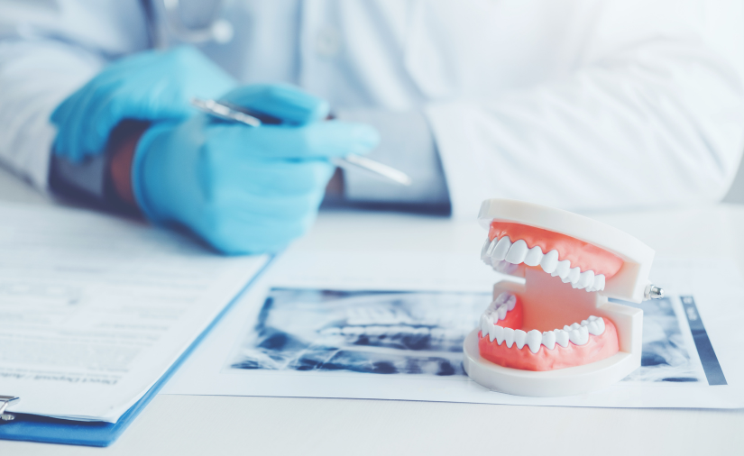 Treatment Options for a Full Mouth Reconstruction