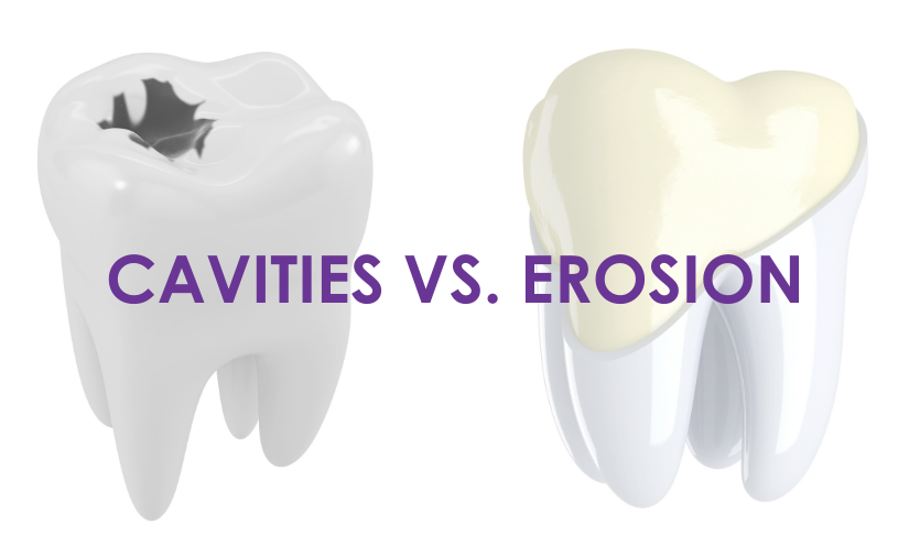 Cavities vs. Tooth Erosion