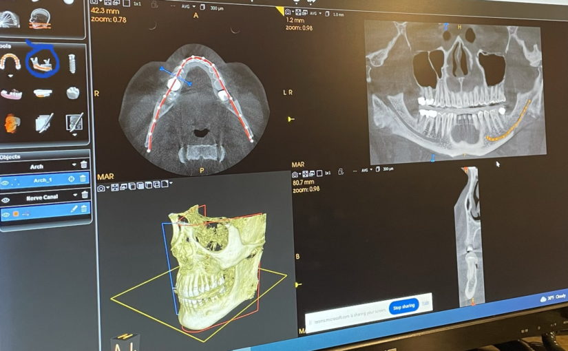 Our Latest Technology Working for You!   Eggert Family Dentistry Adds CBCT